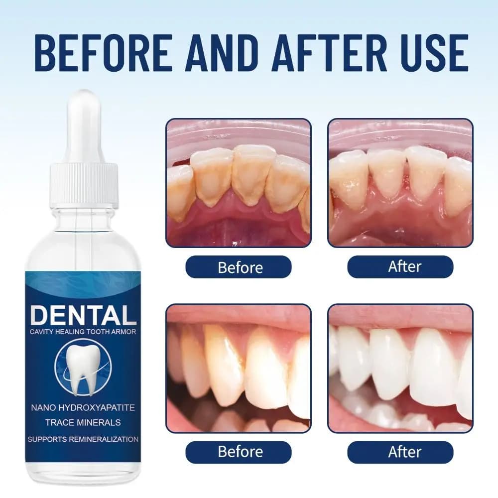 60ml Helps Keep Gum Healthy Cavity Healing Tooth Armor Clinically Strengthen Tooth Enamel Repair Dentite Tooth Armor Liquid
